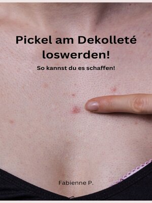 cover image of Pickel am Dekolleté loswerden!